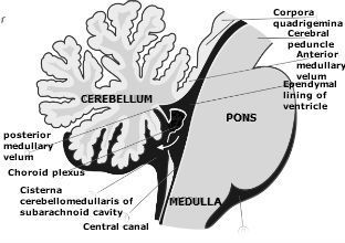 Plexus choroideus hersentumor